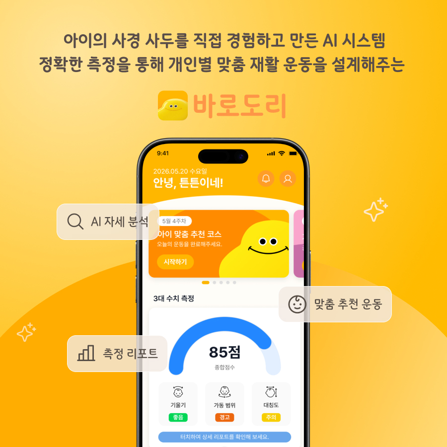 제로더, 영유아 사경·사두 가정 재활 앱 '바로도리' 선보인다 - 뉴스 썸네일 이미지