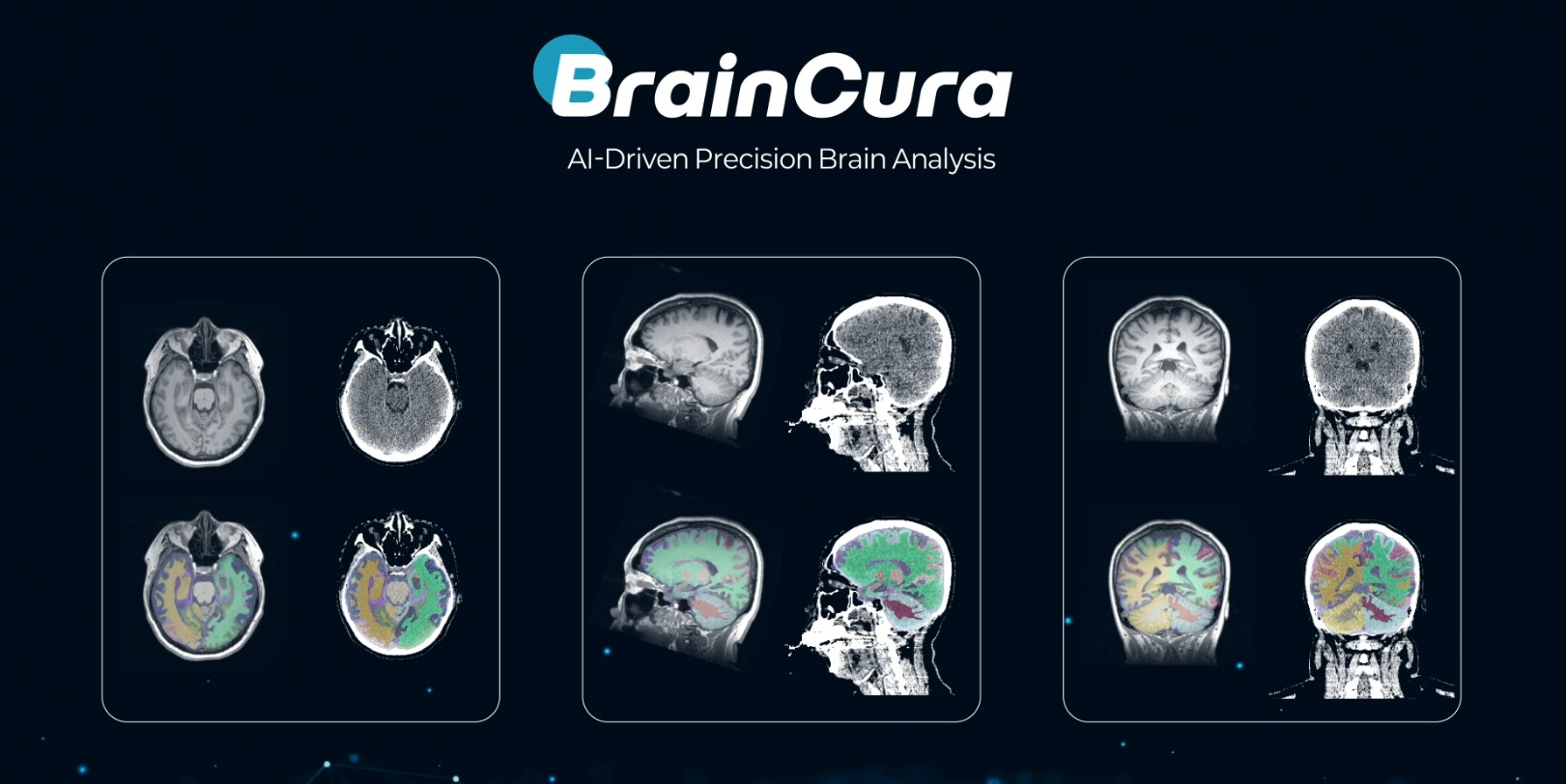 Neuble AI raises $350K seed from FuturePlay for brain disease diagnostic AI